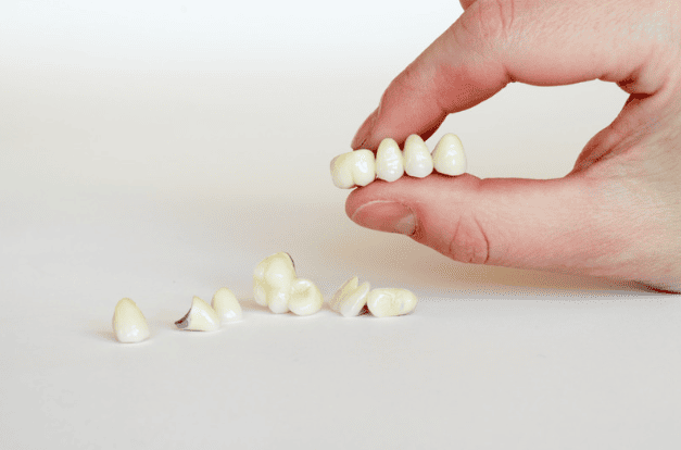 Dental Crowns & Bridges 牙冠及牙橋