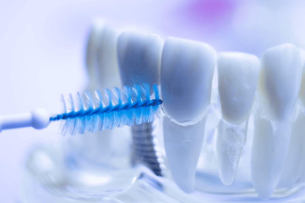 How to Use an Interdental Brush Properly 如何正確使用牙縫刷