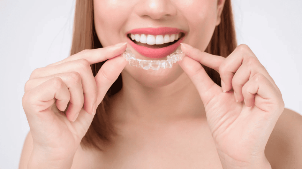 invisalign Invisible Aligners 隱適美 隱形牙箍