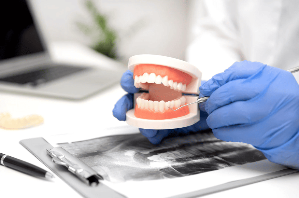 Main Types of Orthodontic Braces 各種牙箍類型比較