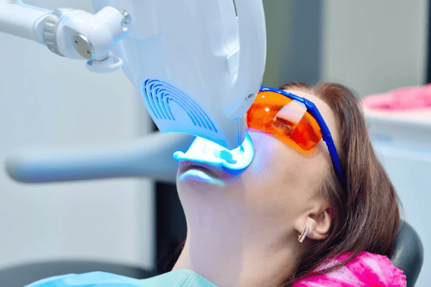 Teeth Whitening 牙齒美白