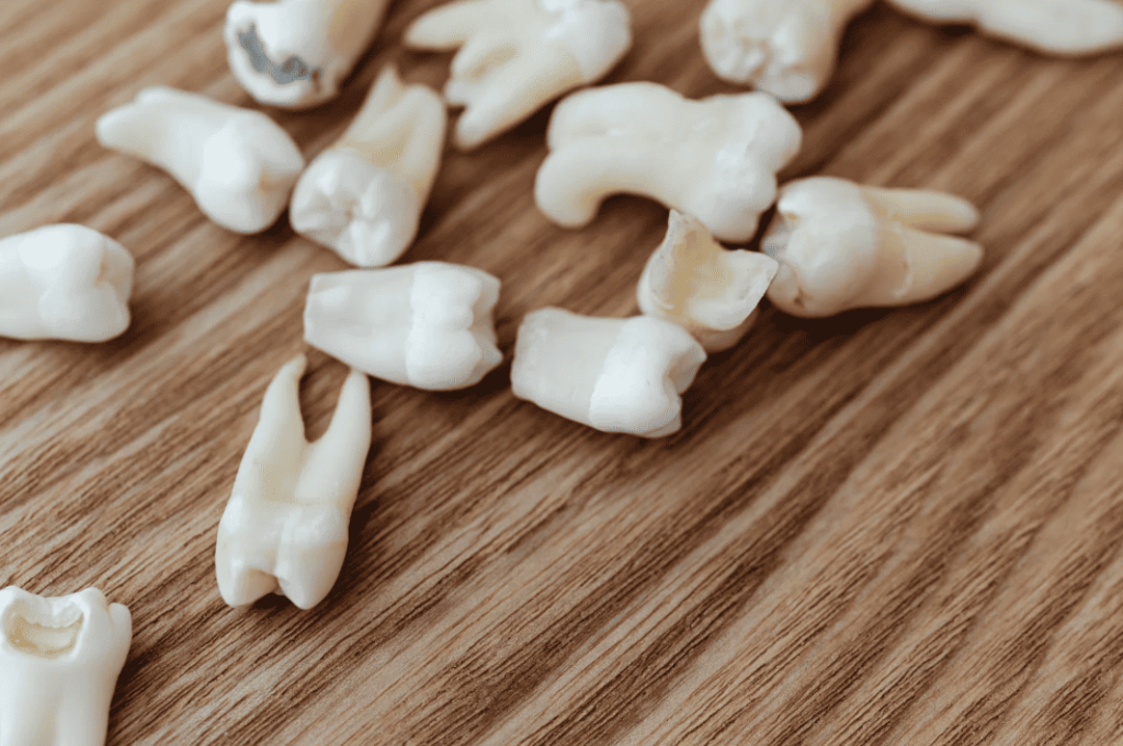 Tooth Decay Symptoms, Prevention, Treatment 蛀牙症狀,預防,治療