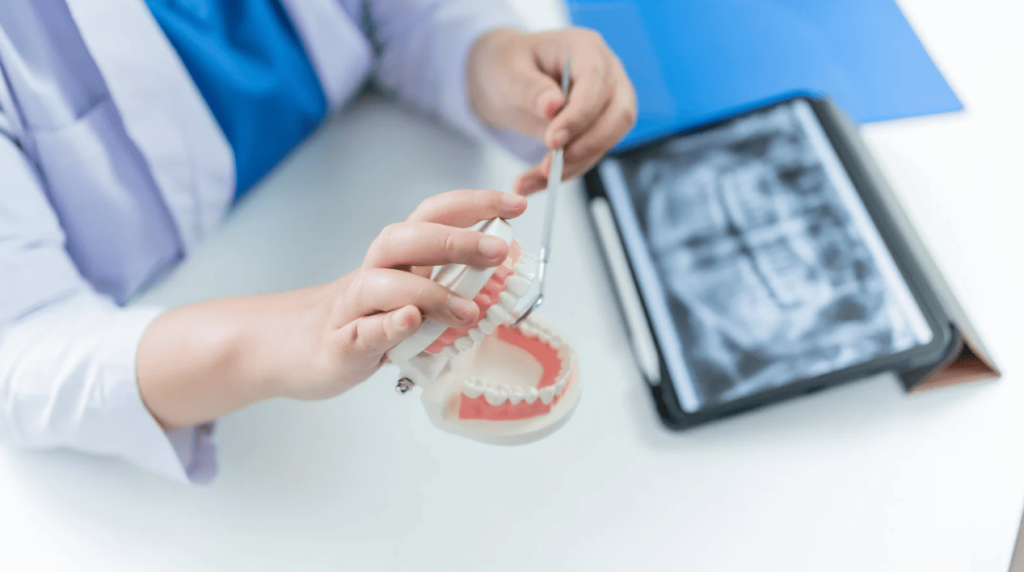 Treatment Methods for Tooth Decay 蛀牙的治療方法