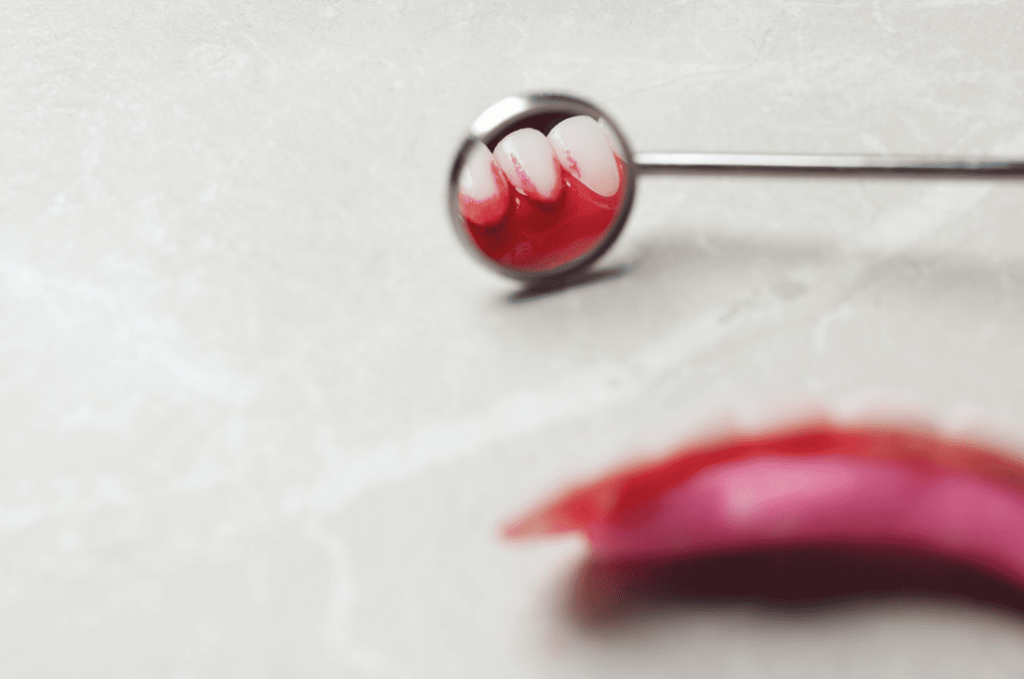 Treatment Options for Gum Disease 牙周病治療