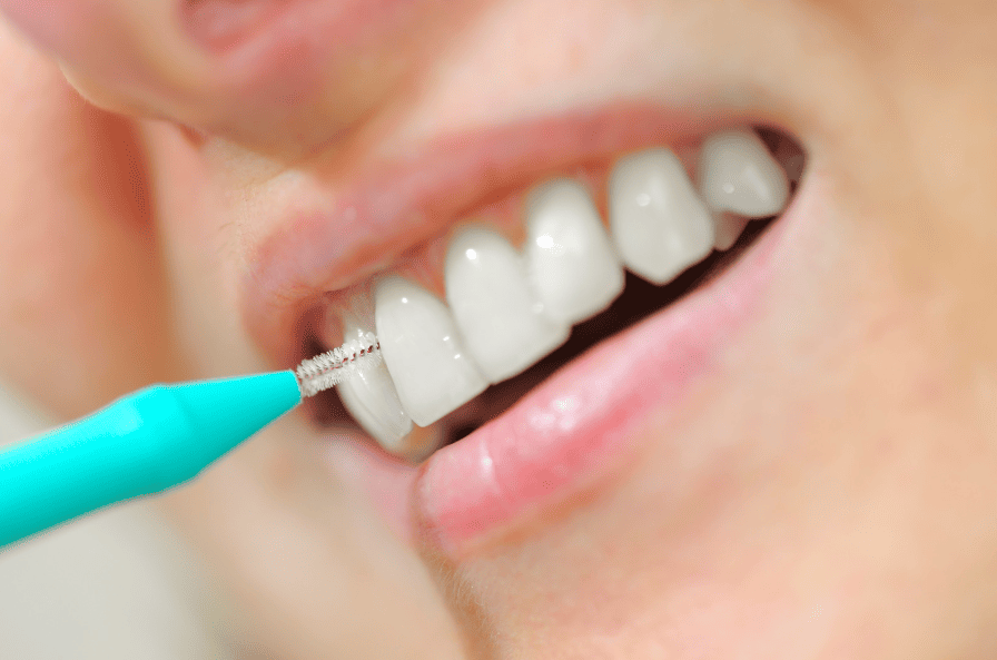 Who Should Use an Interdental Brush 牙縫刷適合什麼人士